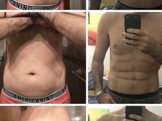 Marcación abdominal 