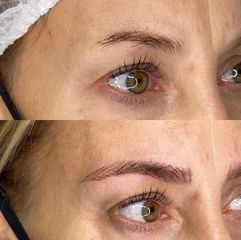 Microblading - Dr. Franco Gomez