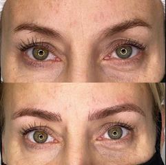 Microblading - Dr. Franco Gomez