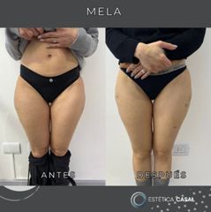 Mela - Estetica Casal