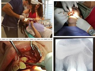 Dental 