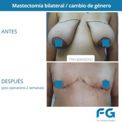 Reasignación de sexo - Dr. Gastón Eduardo Ferreira
