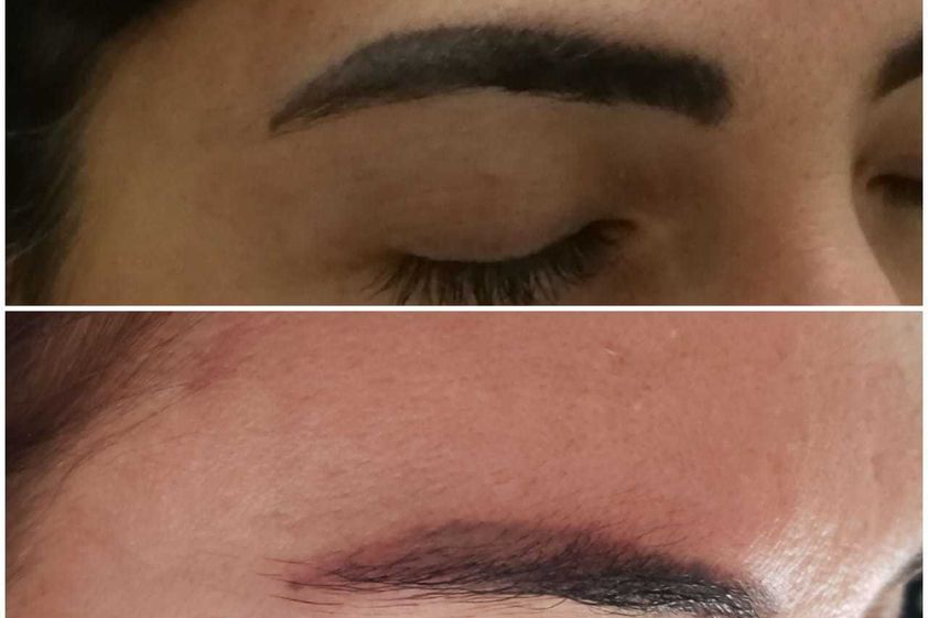 Micropigmentación antes y después - 645907