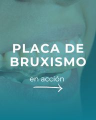 Bruxismo - Oodntologa Macarena Robledo