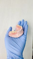 Protesis Dental - Odontóloga Macarena Robledo