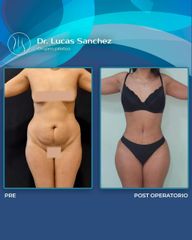 ANTES Y DESPUÉS