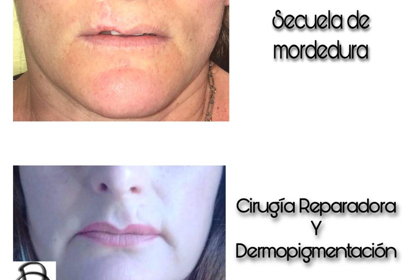Cirugía maxilofacial antes y después - 688228