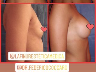 Centro médico Lafinur - Dr. Federico Coccaro 