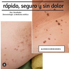 VL Dermatología Estética & Cirugía Plástica