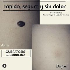 VL Dermatología Estética & Cirugía Plástica