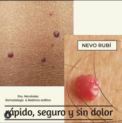 VL Dermatología Estética & Cirugía Plástica