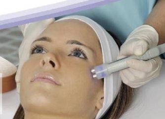 Radiofrecuencia facial 