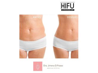 Mesoterapia - 632507