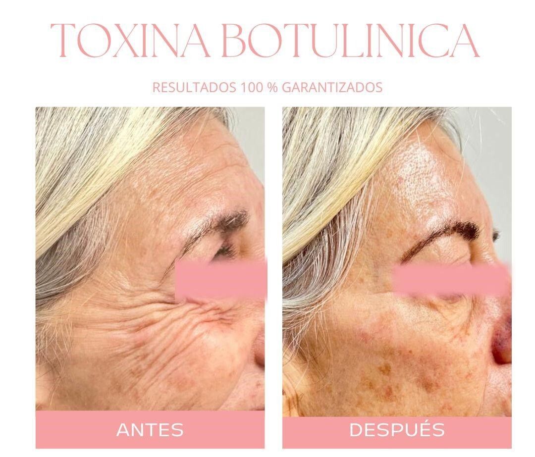 Antes y después - Esteticas.com.ar - Esteticas.com.ar