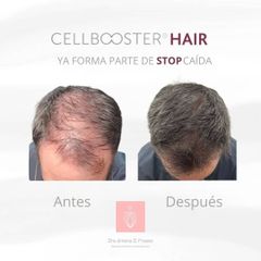 ✨ Cellbooster® Hair- la revolución para fortalecer tu cabello desde la raíz - Dra. Jimena D. Frasso