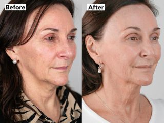 Manchas en la piel - Dra. Jimena D. Frasso