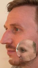 Rejuvenecimiento facial