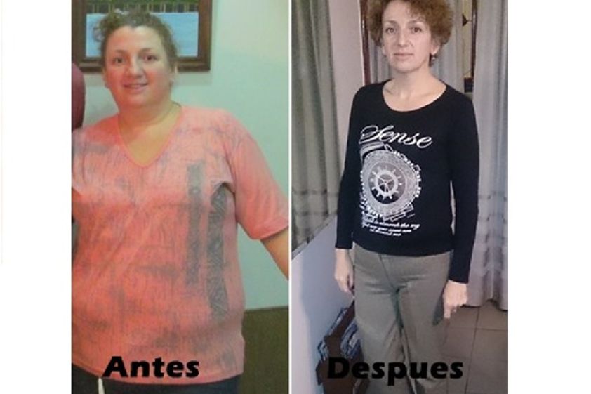 Manga gástrica antes y después - 592697