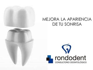 Coronas dentales - Tratamiento odontológico en Córdoba - Consultorio Odontológico en Córdoba