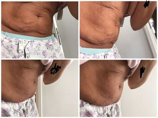 Enzimas Bioactivas