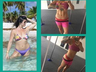 LipoEscultura- Antes y Despues