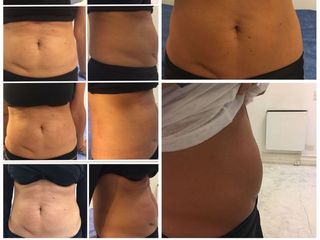 Enzimas Bioactivas