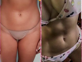 Antes y después liposucción