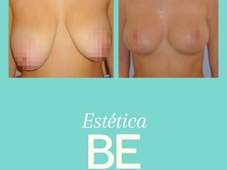 Antes y Después