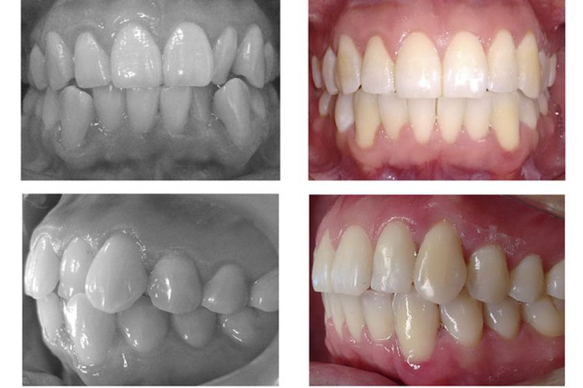 Ortodoncia antes y después - 623671