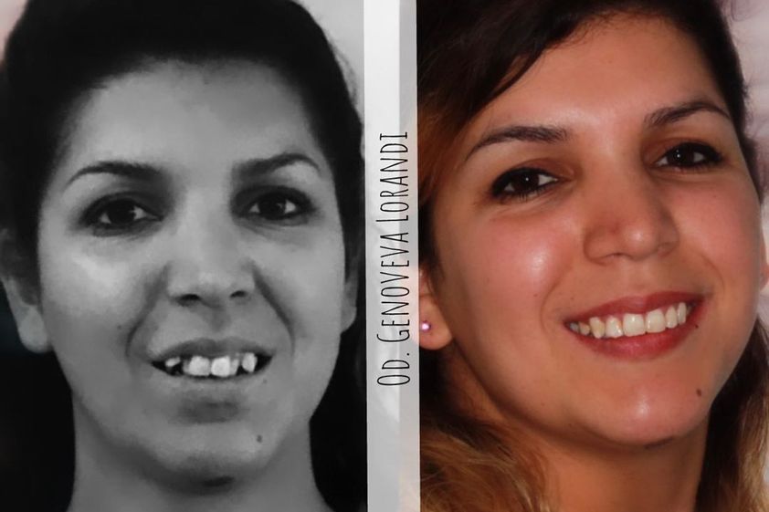 Ortodoncia antes y después - 739135