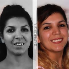 Ortodoncia - Dra. María Genoveva Lorandi