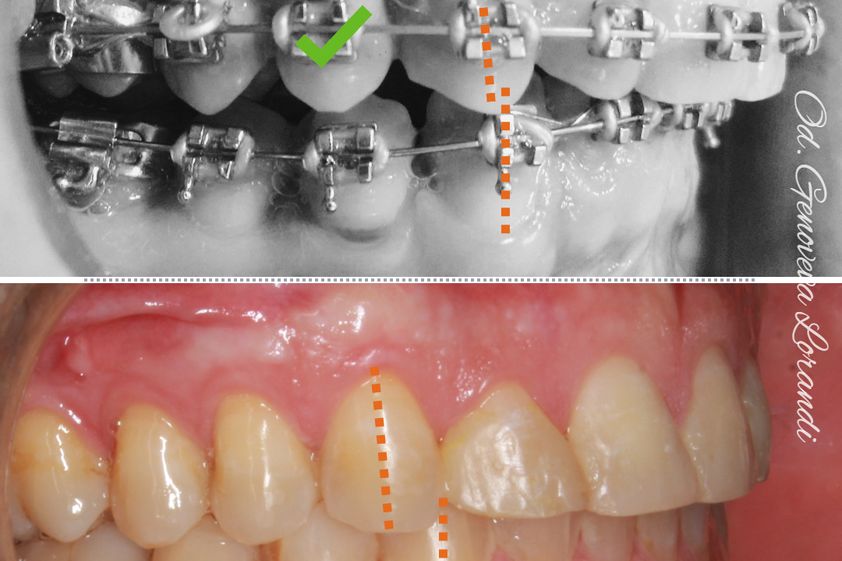 Ortodoncia antes y después - 819112
