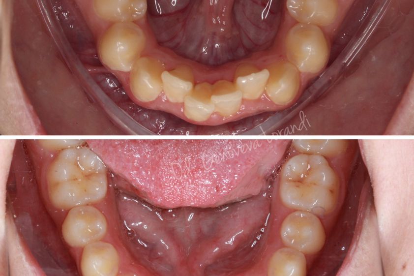 Ortodoncia antes y después - 821069