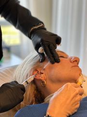 Rejuvenecimiento Facial - Dra. Maria Victoria Rodriguez