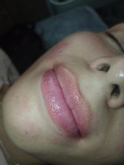 BB Lips