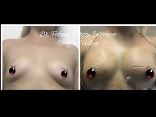 Dr. Fabian Vargas Carrasco