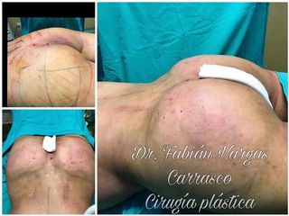 Dr. Fabian Vargas Carrasco 