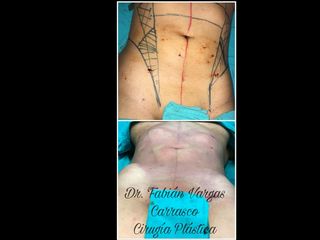 Dr. Fabian Vargas Carrasco 