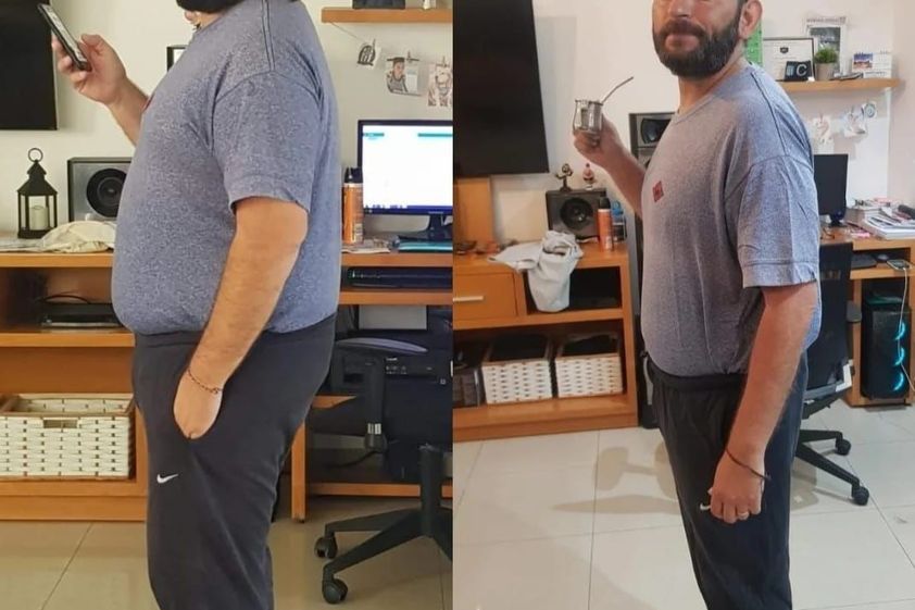 Manga gástrica antes y después - 811052