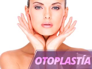 Otoplastia