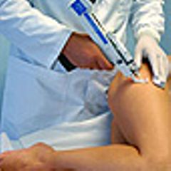 Mesoterapia
