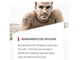 Borrar tatuajes