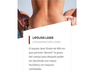 Lipólisis laser.