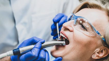 Limpieza dental profesional - Pineda Dental Studio