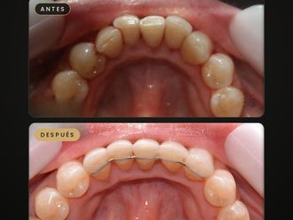Ortodoncia antes y después - 881747