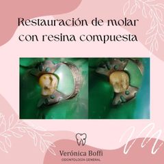 Endodoncia - Dra. Verónica Boffi