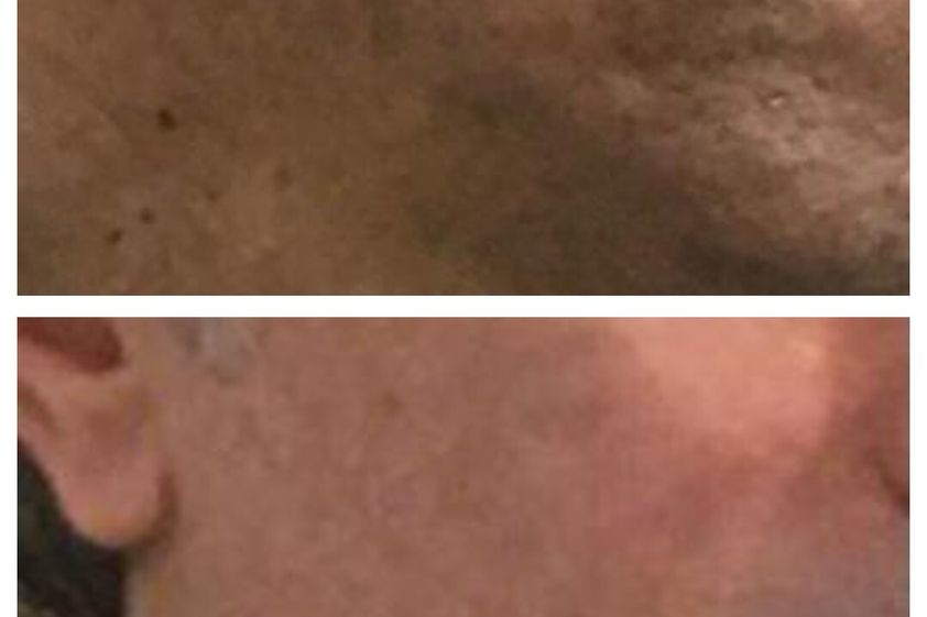 Láser CO2 antes y después - 790668