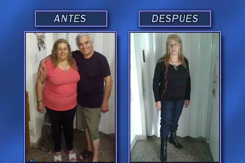 Dietas antes y después - 623251