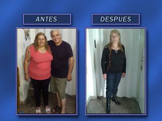 Antes y después - descenso de peso