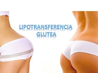 Lipoescultura